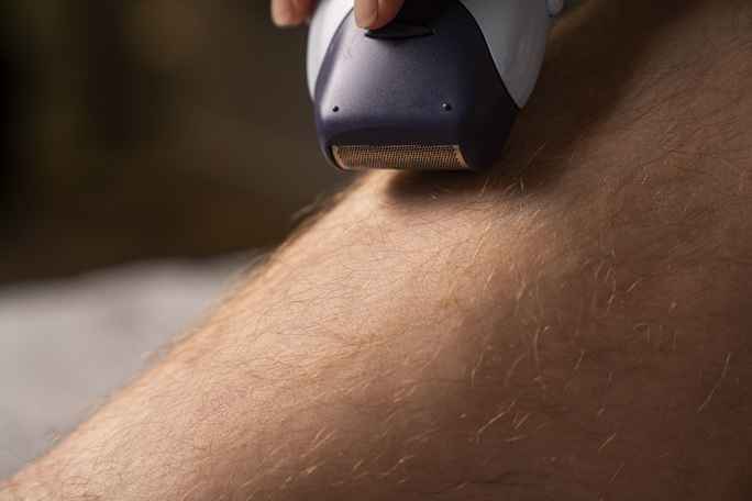 Guidelines Preoperative Hair Removal